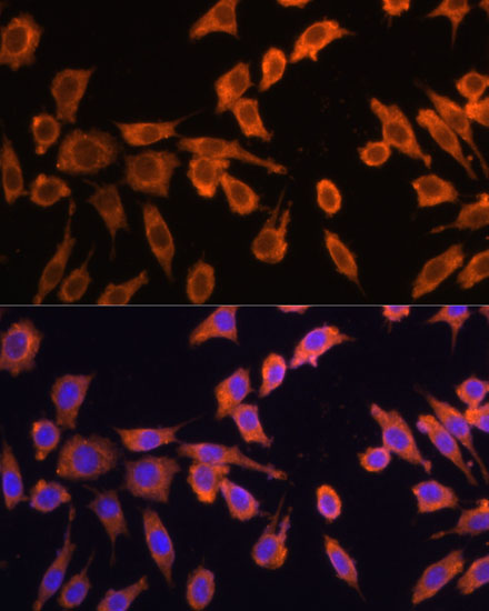 Anti-DRP1 Antibody (CAB16661)