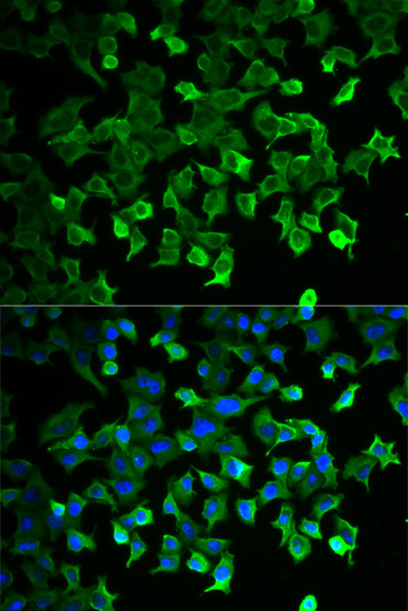 Anti-HSP70 Antibody (CAB0284)