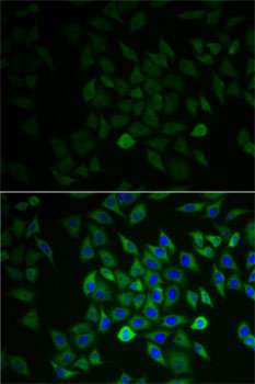 Anti-GNB2L1 Antibody (CAB0151)