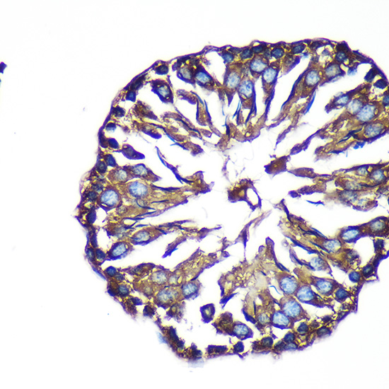 Anti-ACTR1B Antibody (CAB15773)