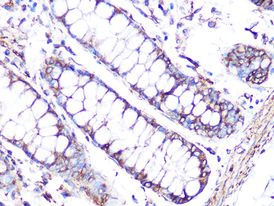 Anti-Tubulin alpha 1b Antibody