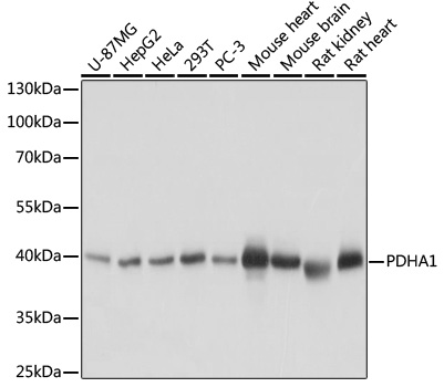 Anti-PDHA1 Antibody (CAB17432)