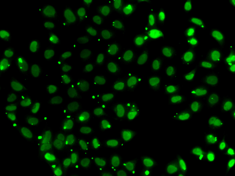 Anti-SUB1 Antibody (CAB7070)