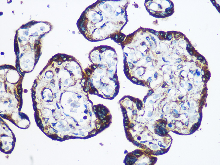 Anti-YTHDF2 Antibody (CAB15616)