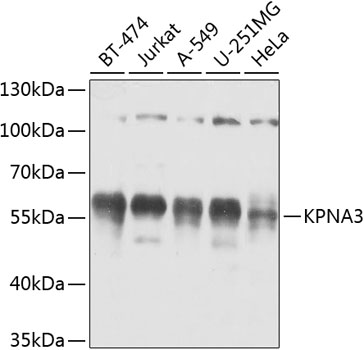 Anti-KPNA3 Polyclonal Antibody (CAB8347)