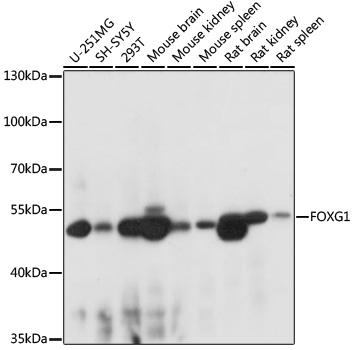 Anti-FOXG1 Antibody (CAB16851)