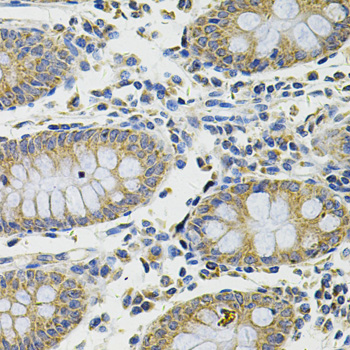 Anti-DDX20 Antibody (CAB5817)