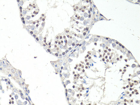 Anti-FTO Antibody (CAB1438)