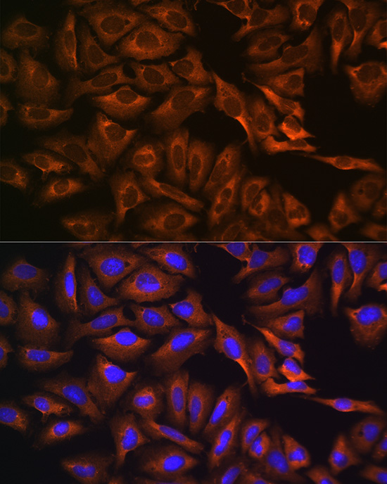 Anti-CAPRIN1 Antibody (CAB7910)