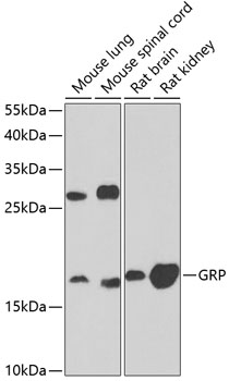 Anti-GRP Antibody (CAB6380)