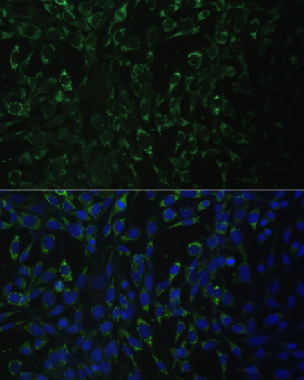 Anti-ALDH1A2 Antibody (CAB7503)