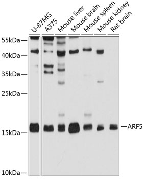 Anti-ARF5 Antibody (CAB3737)