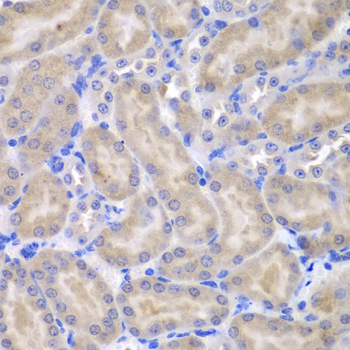 Anti-ASPSCR1 Antibody (CAB7481)