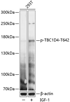 Anti-Phospho-TBC1D4-T642 pAb (CABP0791)