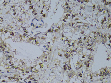 Anti-HUS1 Antibody (CAB13938)