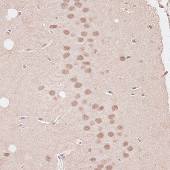 Anti-ZNF346 Antibody (CAB13406)