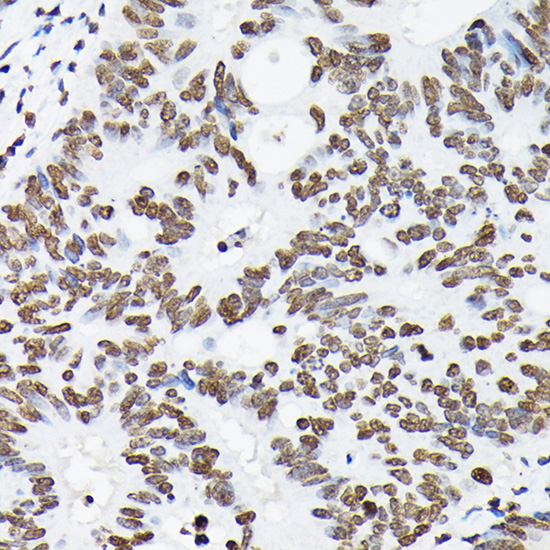 Anti-DiMethyl-Histone H3-K9 Antibody (CAB2359)