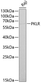 Anti-PKLR Antibody (CAB1924)