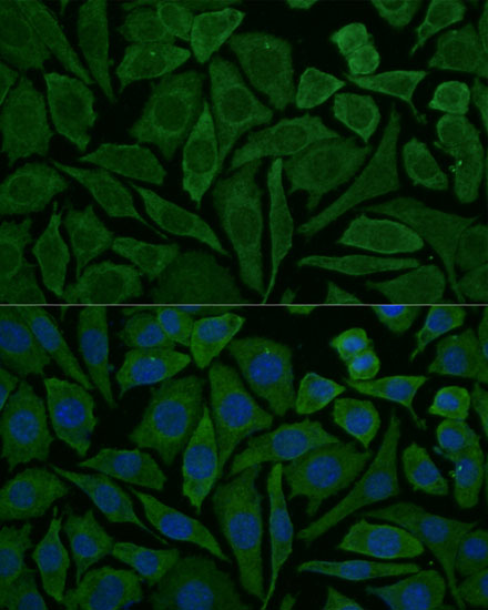 Anti-NDUFB2 Antibody (CAB3978)