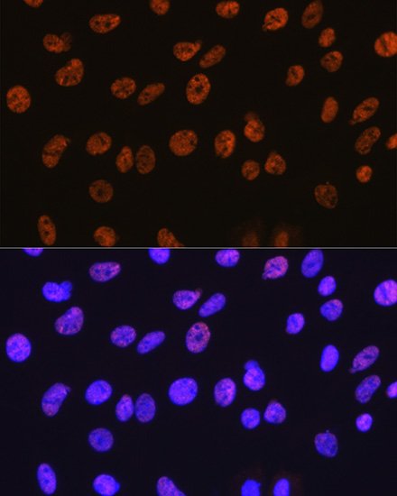 Anti-HDAC1 Antibody [KO Validated] (CAB19571)