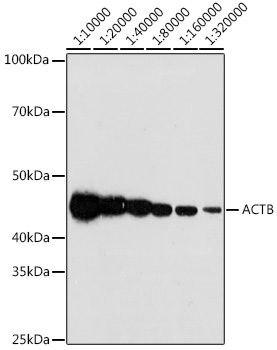 Anti-Beta Actin Rabbit Monoclonal Antibody