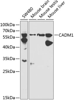 Anti-CADM1 Antibody (CAB1892)