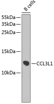 Anti-CCL3L1 Antibody (CAB2852)