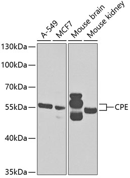 Anti-CPE Antibody (CAB5458)