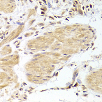 Anti-Caspase-2 Antibody (CAB5724)