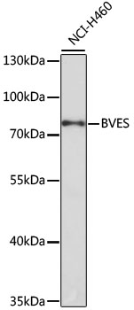 Anti-BVES Antibody (CAB0213)