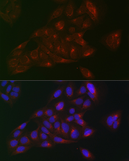 Anti-RAB1B Antibody (CAB7514)