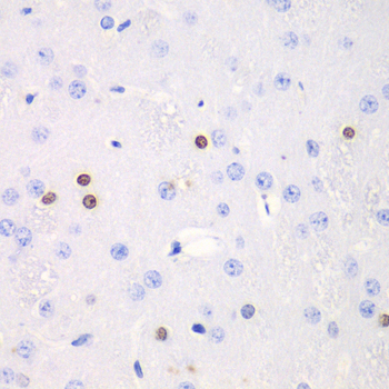 Anti-TKT Antibody (CAB13553)