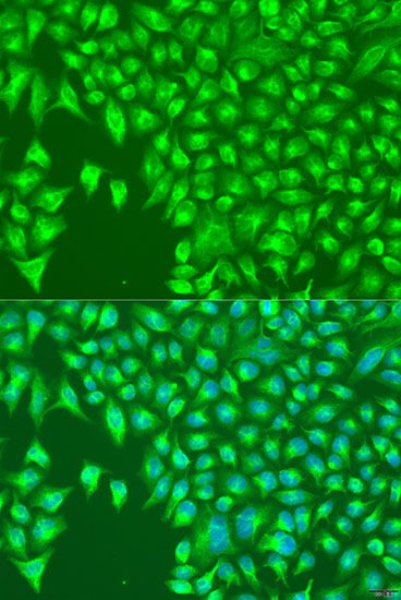 Anti-KIR2DS4 Antibody (CAB1779)