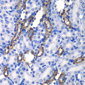 Anti-MATK Antibody (CAB6651)