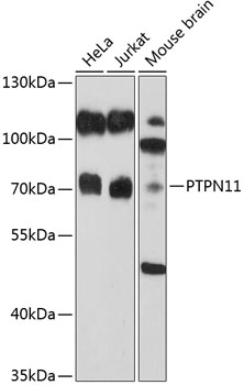 Anti-PTPN11 Antibody (CAB2793)