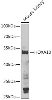 Anti-HOXA10 Polyclonal Antibody (CAB8550)