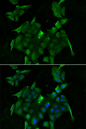 Anti-SLC34A1 Antibody (CAB6742)