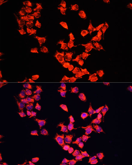 Anti-FXR1 Antibody (CAB5942)