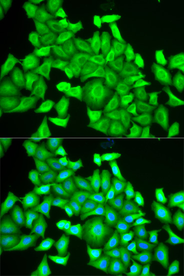 Anti-RAB6A Antibody (CAB5613)