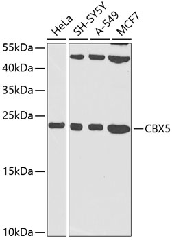 Anti-CBX5 Antibody (CAB12592)