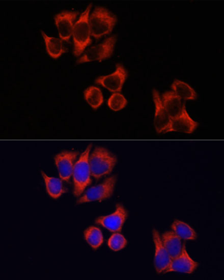 Anti-TLR4 Antibody (CAB5258)