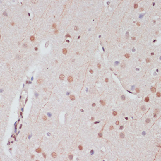 Anti-CREB1 Antibody (CAB11989)