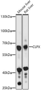 Western blot analysis of extracts of various cell lines, using CLPX antibody at 1:1000 dilution. Secondary antibody: HRP Goat Anti-Rabbit IgG (H+L) at 1:10000 dilution. Lysates/proteins: 25ug per lane. Blocking buffer: 3% nonfat dry milk in TBST. Detection: ECL Basic Kit. Exposure time: 10s.