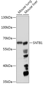 Anti-SNTB1 Antibody (CAB17534)
