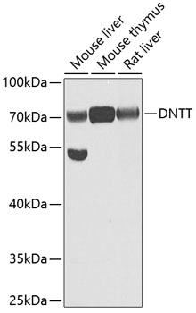 Anti-DNTT Antibody (CAB6254)