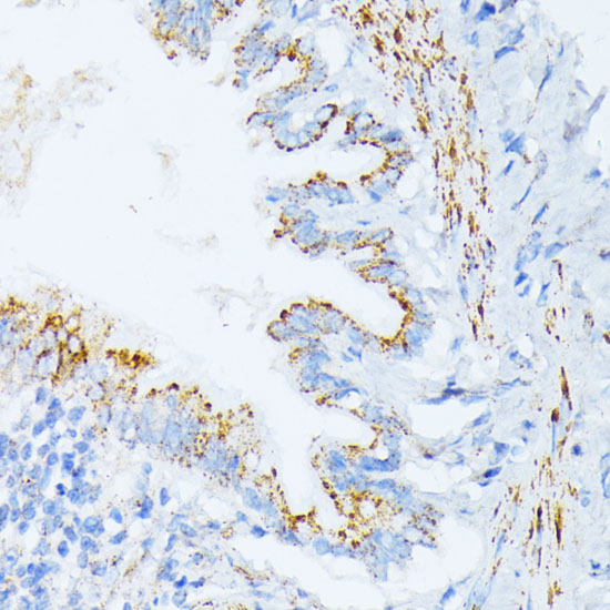 Anti-IL-3RA Antibody (CAB3926)