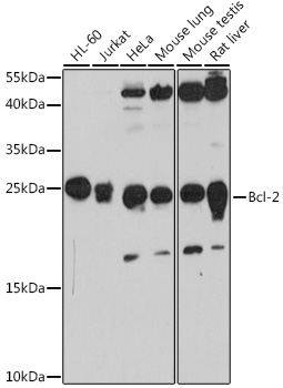 Anti-Bcl-2 Antibody (CAB11025)