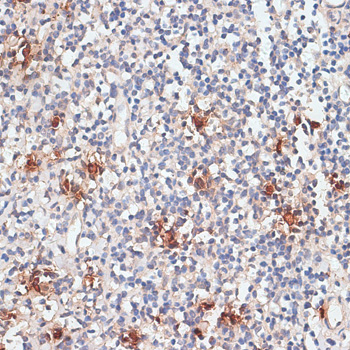 Anti-CTSG Antibody (CAB13172)