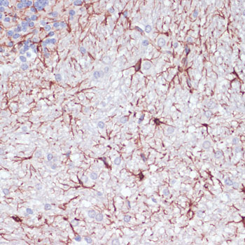 Anti-GFAP Antibody (CAB14673)