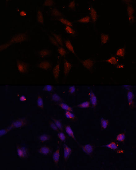 Anti-c-Fos Antibody (CAB16641)